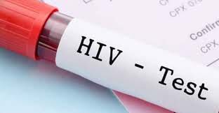 درمان موثر می‌تواند ایپدمی HIV را مهار کند