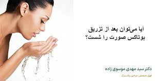 چند ساعت بعد از بوتاکس می‌توان صورت را شست؟