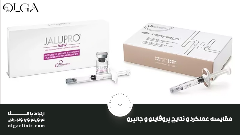 پروفایلو یا جالپرو؛ مقایسه عملکرد